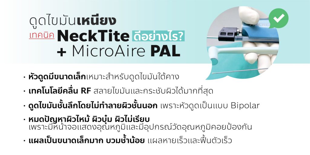 ดูดไขมันเหนียง เทคนิคใหม่ปี 2022 NeckTite + PAL