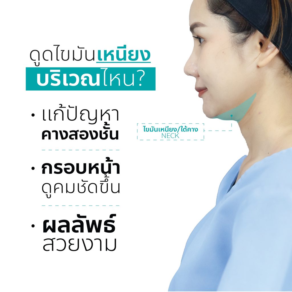 ดูดไขมันเหนียง จุดไหน