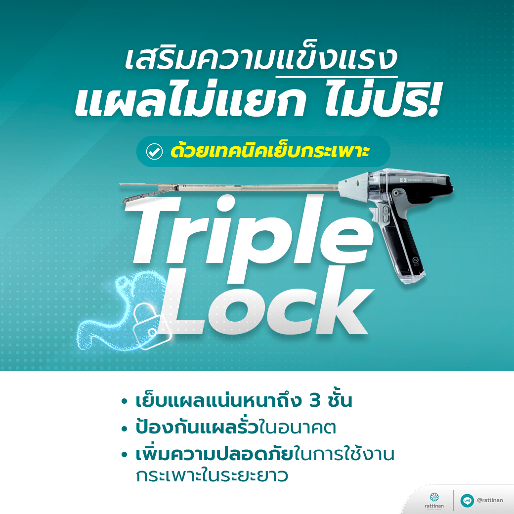 Triple Lock ตัดกระเพาะ ลดน้ำหนัก